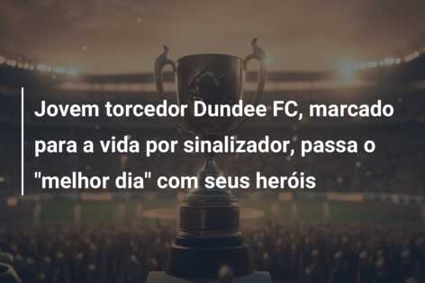 Jovem torcedor Dundee FC, marcado para a vida por sinalizador, passa o “melhor dia” com seus heróis
