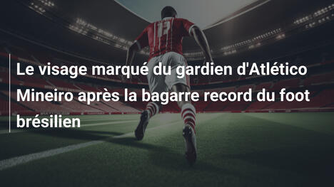 Le visage marqué du gardien d'Atlético Mineiro après la bagarre record du foot brésilien