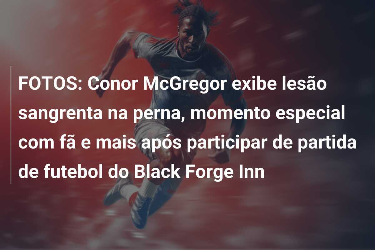 FOTOS: Conor McGregor exibe lesão sangrenta na perna, momento especial com fã e mais após participar de partida de futebol do Black Forge Inn