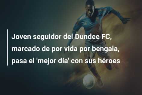 Joven seguidor del Dundee FC, marcado de por vida por bengala, pasa el ‘mejor día’ con sus héroes